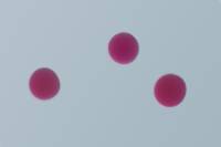 Oursin - embryologie - Ovocytes d'Oursin x100